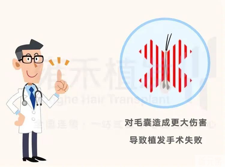 植发器械口径，真的越小越好吗? 图片-3