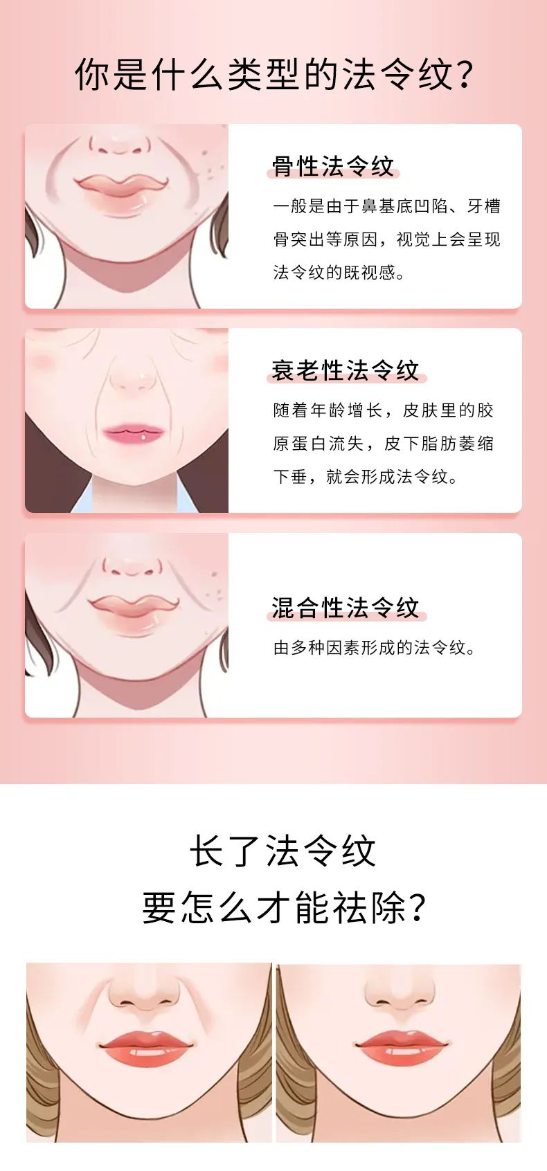 法令纹越填越深?那是没用对方法! 图片-2