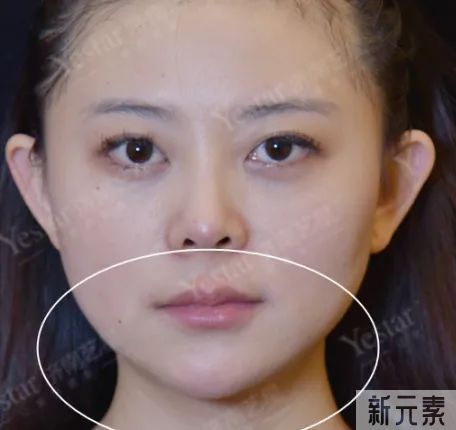 摘下口罩老20岁，竟然是因为你的下排牙?? 图片-10