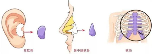 想在Ta鼻子上“坐滑滑梯”的那种美鼻，攻略来咯! 图片-3