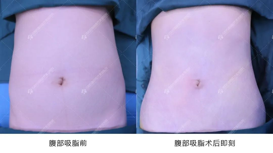 每次减肥都是3分钟热度的姐妹们，看看这个吧 图片-6