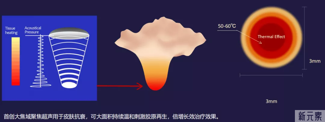 哪些嫩肤美白技术能让你拥抱少女初恋肌，开启春日变美攻略! 图片-8