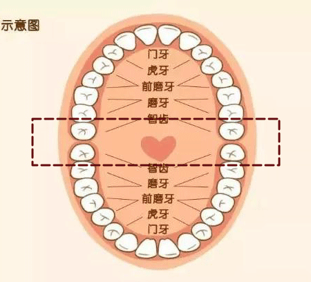 科普来了 | 为什么不建议一次性拔掉4颗智齿? 图片-8