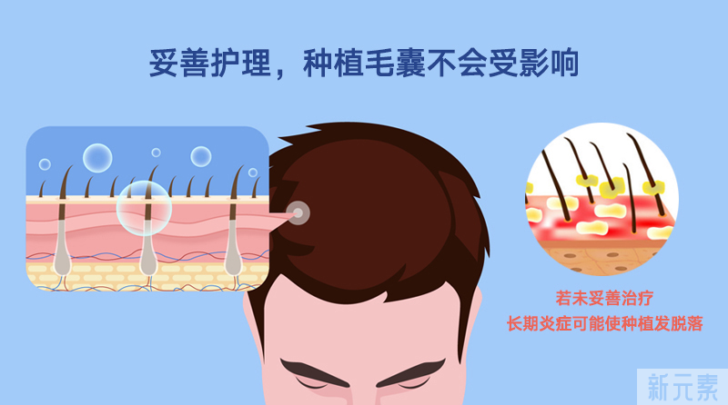 为什么植发后会出现毛囊炎?应该如何预防? 图片-4