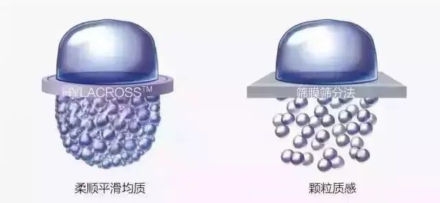 热玛吉|为什么它这么贵，还有人买买买? 图片-6