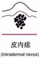 当经典“黑白配”长在了人的身上，你知道这其实是一种疾病吗? 图片-6