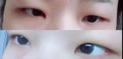 戴口罩能变好看?小心长期戴口罩颜值「明升暗降」! 图片-6