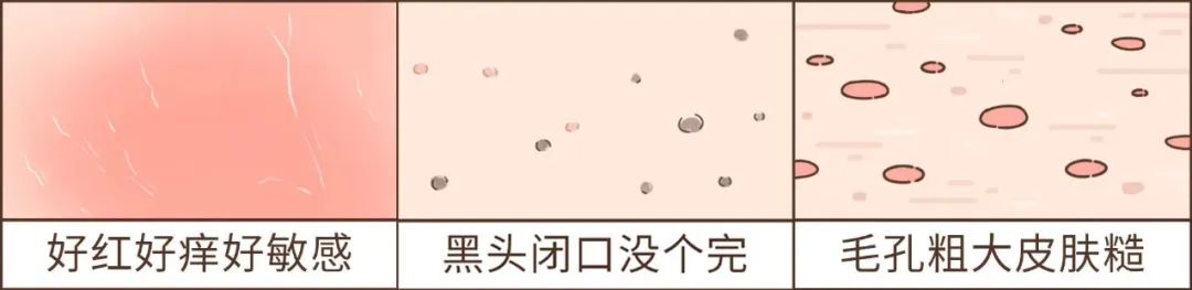 戴口罩能变好看?小心长期戴口罩颜值「明升暗降」! 图片-11