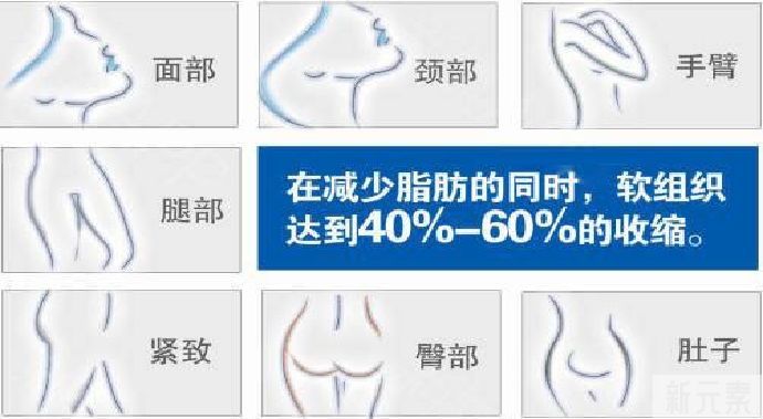 被双下巴糊掉的“少女线”如何拯救? 图片-5