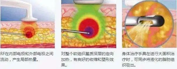 被双下巴糊掉的“少女线”如何拯救? 图片-4