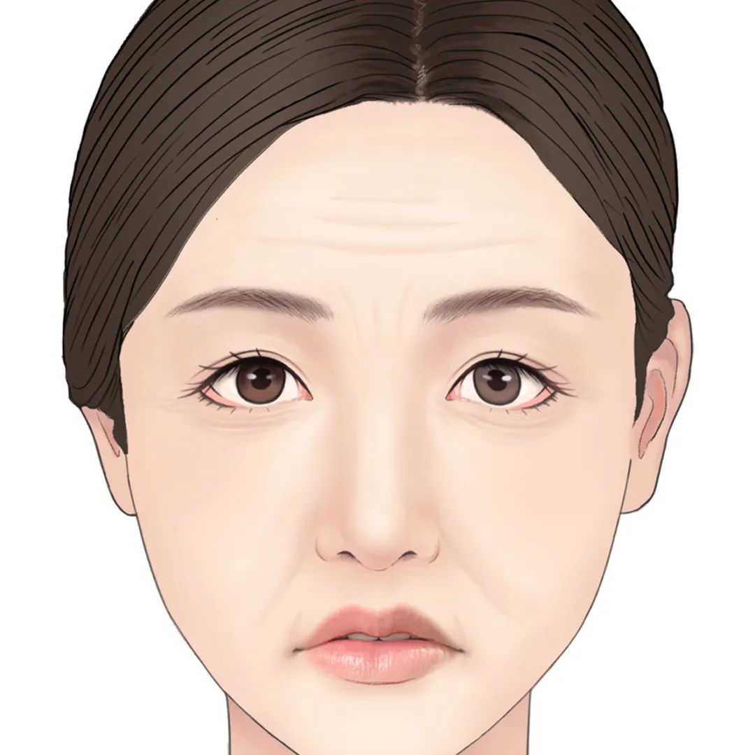 【玻尿酸】值得买吗?选哪种产品?你关心的都在这! 图片-8