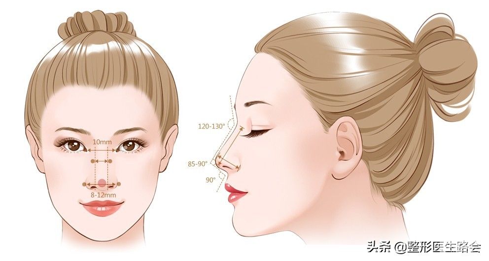 网络大热，医生热荐的“肋软骨鼻”真的那么好吗? 图片-1