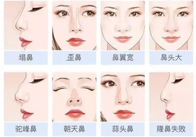成都铜雀台鼻修复全城招募，戳进来查看详情 图片-15