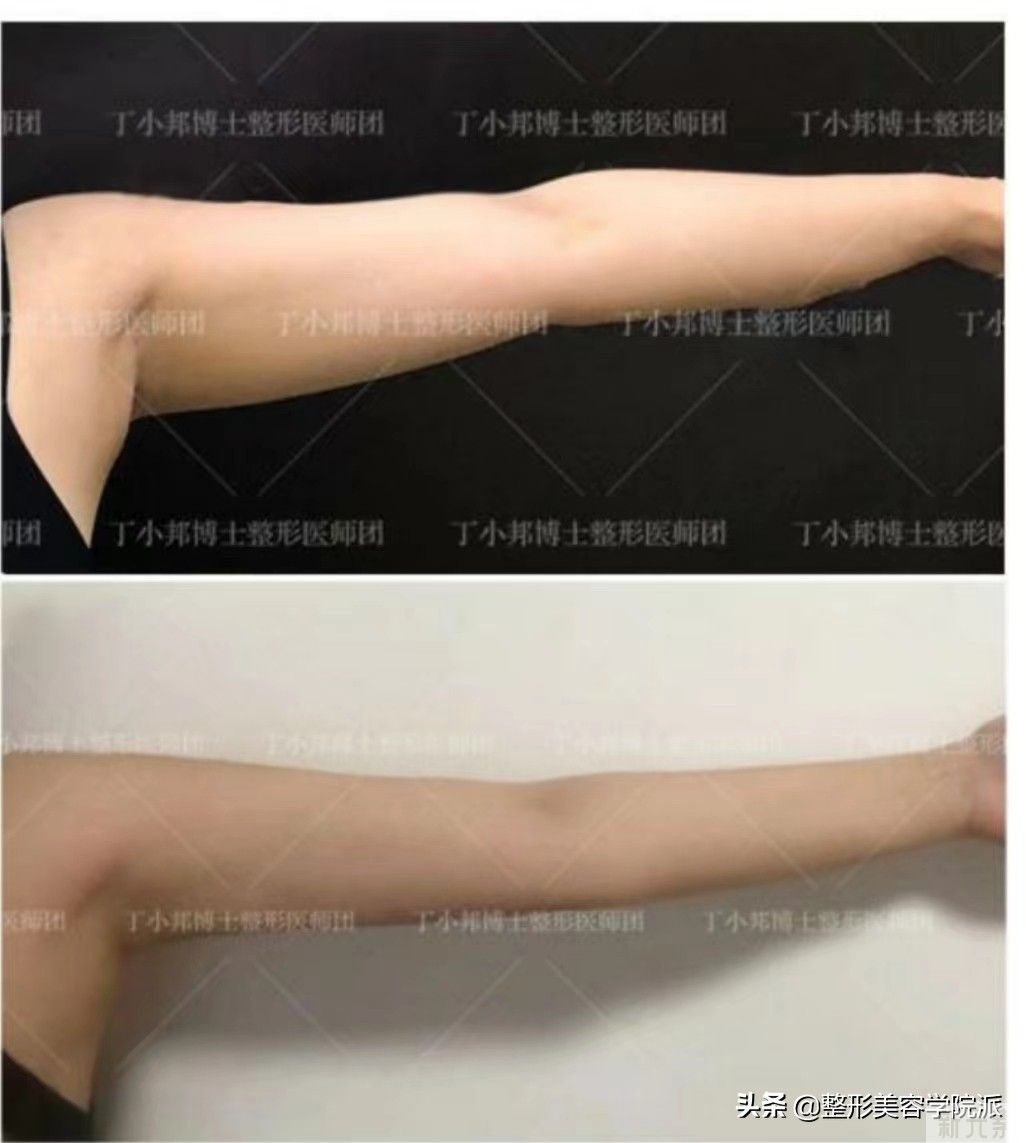 夏天到了如何给上臂摆摆肉彻底说“拜拜”!   图片-1