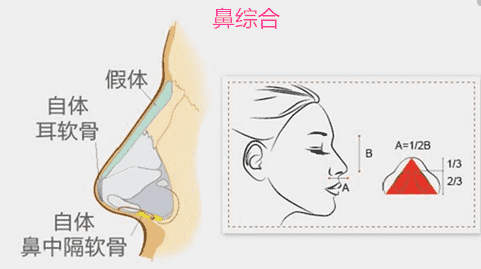 为什么做了鼻子还是不好看? 图片-2