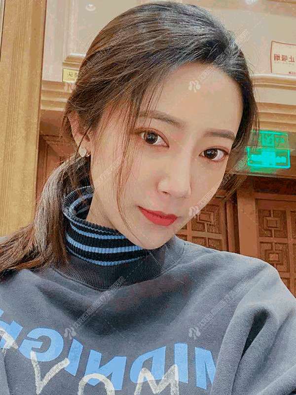 别让原装鼻子配不上新做的眼睛，一起美才是硬道理 图片-4