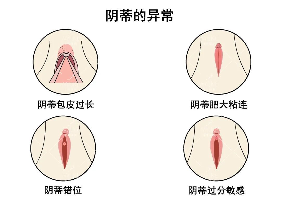 不能错过!女性必备的私密护理科普! 图片-7