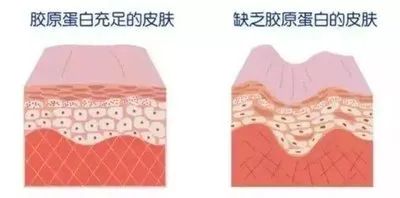 法令纹越填越深?可能是你一开始就弄错了 图片-5