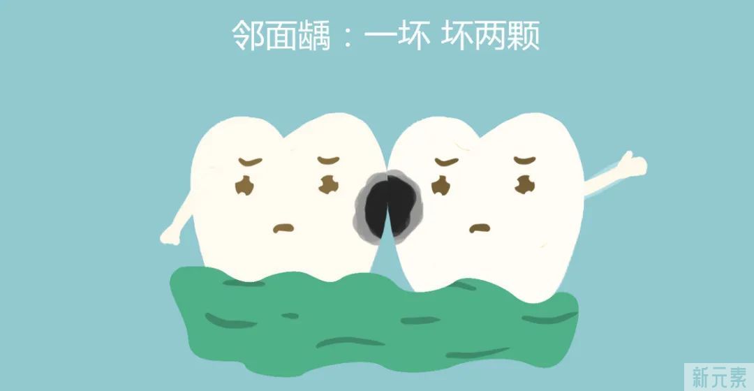 聊医聊 | 补牙前为什么要先磨牙洞? 图片-8