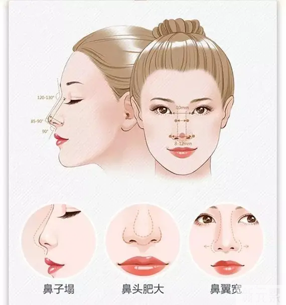 鼻手术为什么医生建议你做软骨? 图片-1
