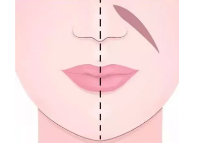 年纪轻轻居然有法令纹?看你属于哪一种? 图片-7