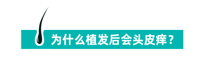 植发后，头皮特别痒怎么办? 图片-1