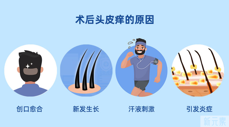 植发后，头皮特别痒怎么办? 图片-3
