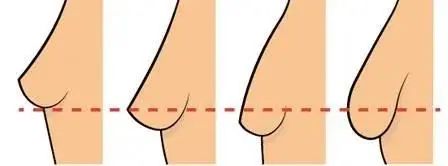女生夏季长时间不穿bra会怎么样? 图片-5