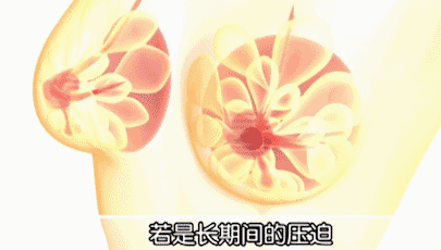 女生夏季长时间不穿bra会怎么样? 图片-3