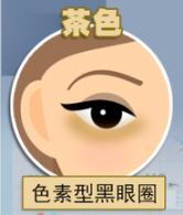黑眼圈+泪沟，化妆都掩盖不住的显老BUG怎么破? 图片-7