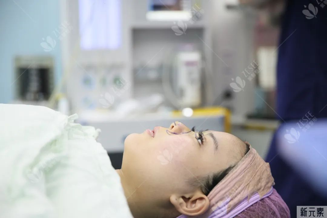 隆鼻是什么体验，我想你并不知道...... 图片-8