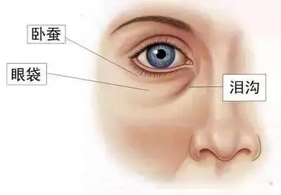 眼袋太显老，到底该怎么办? 图片-3