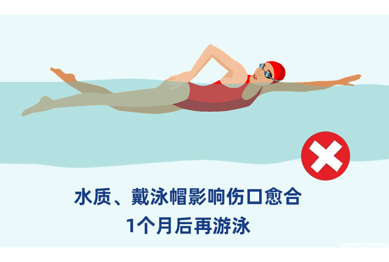 植发后多久可以运动、游泳、泡温泉? 图片-1