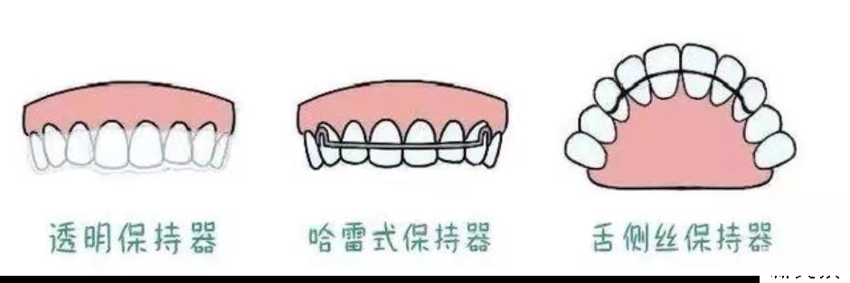 网购牙套做矫正?你可真是大冤种! 图片-18