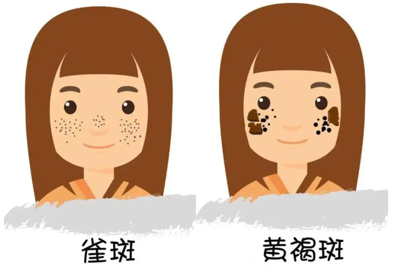 史上最全的PicoWay超皮秒科普，赶紧收藏! 图片-2