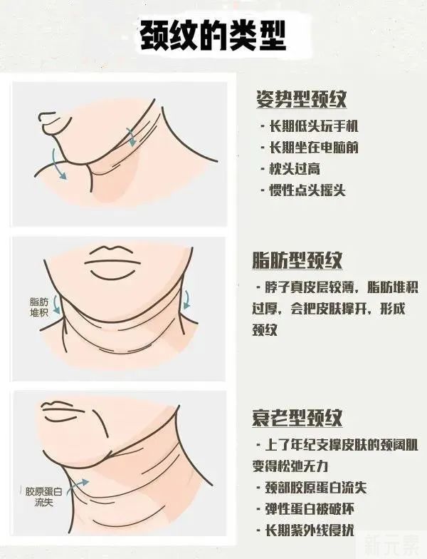 颈纹!芭比Q了!一招KO超简单! 图片-3