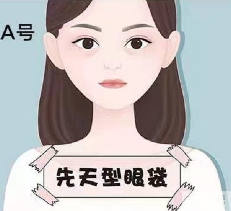 女人都爱的“减龄术”，眼袋、泪沟一起带走 图片-3