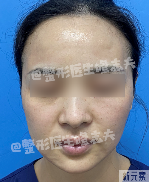 干纹、卡粉、起皮?护肤方法该注意了 图片-15
