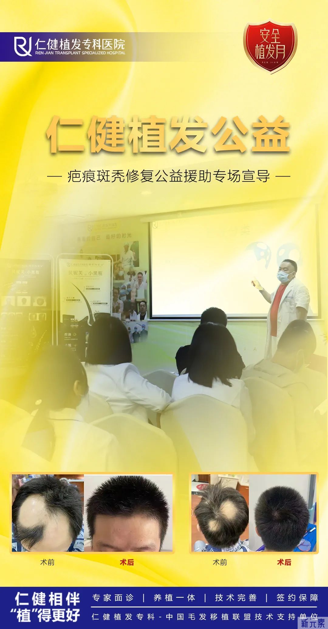 仁健植发公益丨疤痕斑秃修复公益援助专场宣导 图片-6