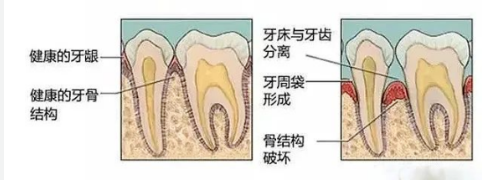牙缝为何会越来越大? 图片-14