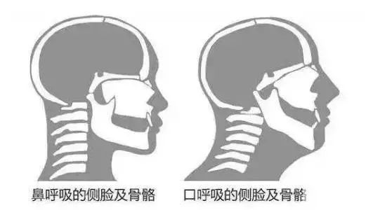 发腮?下颌线失踪?怎么救? 图片-5
