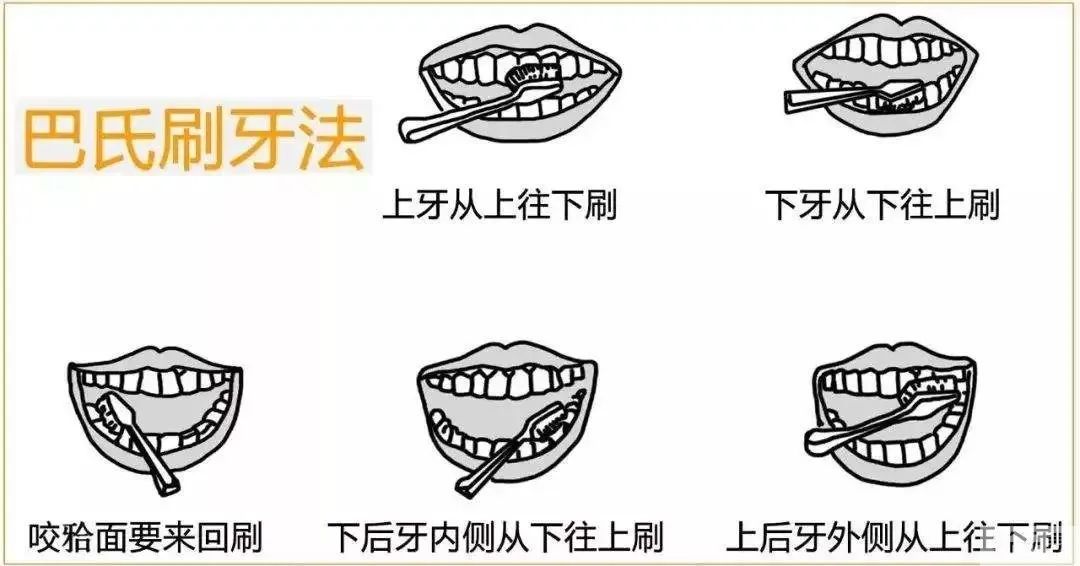 种植牙:能媲美真牙，也一样怕它! 图片-9