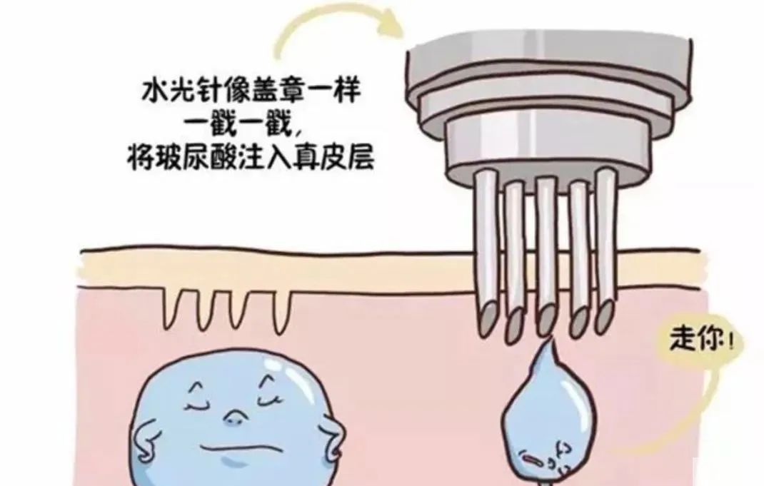 打水光针需要注意什么? 图片-4