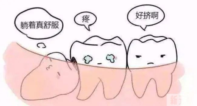聊医聊 | 有问题的智齿，可以不拔? 图片-5