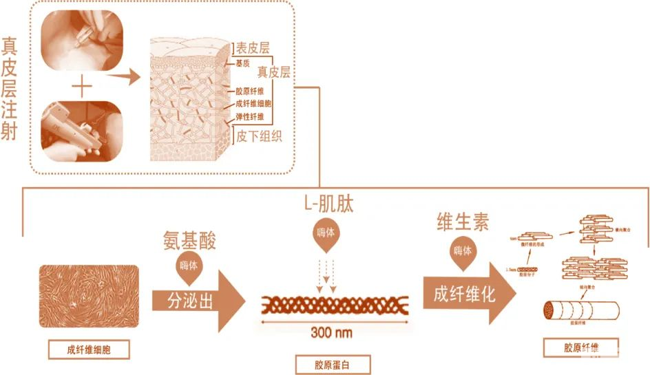 熬夜最伤精细眼周，嗨体可修护，教你选择适合自己的规格 图片-3
