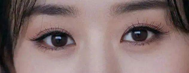 【干货】双眼皮选择困难?进来看! 图片-7
