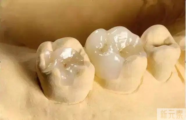 科普来了 | 补牙用的树脂究竟是什么?补牙效果好吗? 图片-3