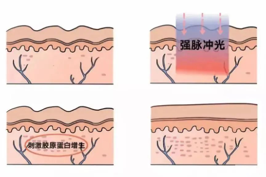 拒绝护肤“摆烂”，这一次我一定要赢! 图片-11