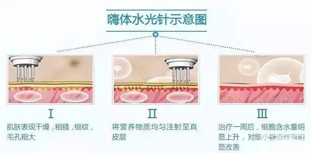 颈纹越除越多?方法用错都是白搭! 图片-9