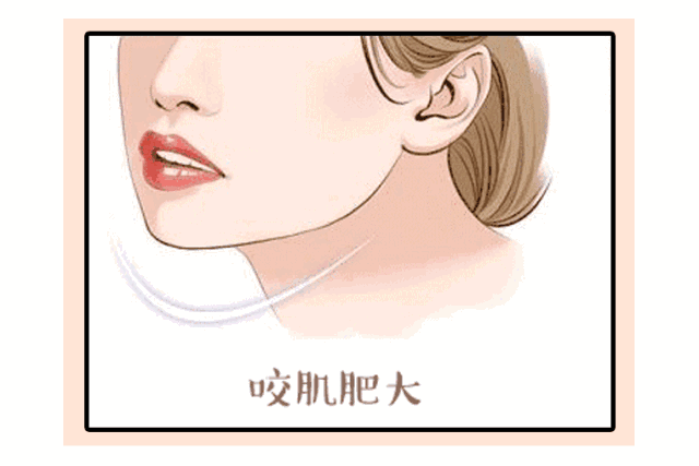 脸越来越大，可不全是因为胖! 图片-29